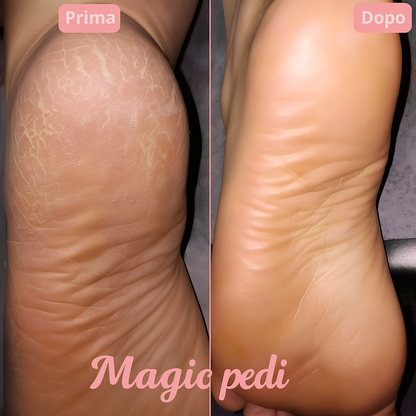 Magic Pedi™|Lima elettrica per piedi lisci